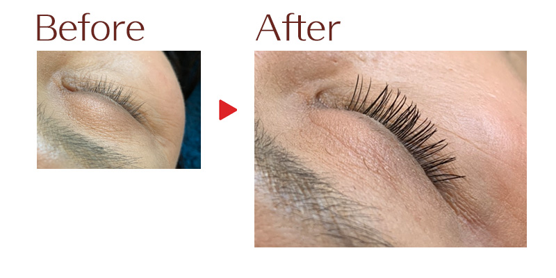 目元のビフォーアフター2