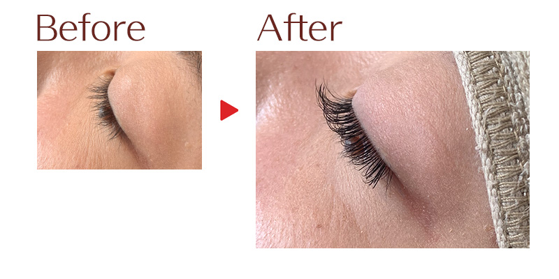 目元のビフォーアフター4