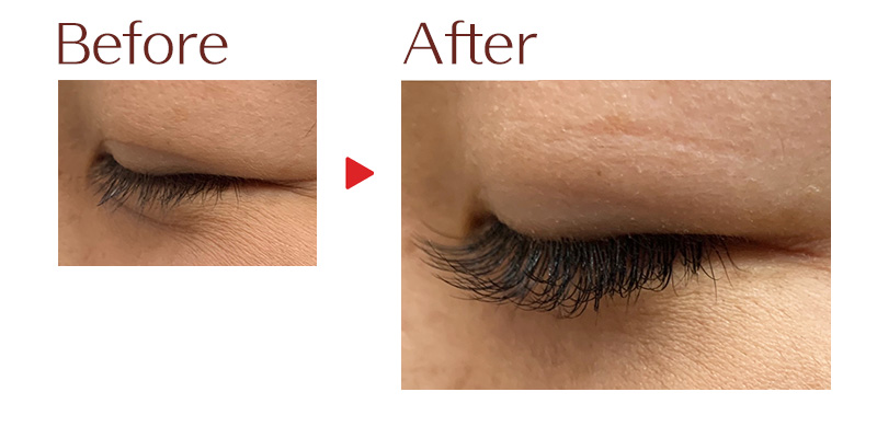 目元のビフォーアフター5