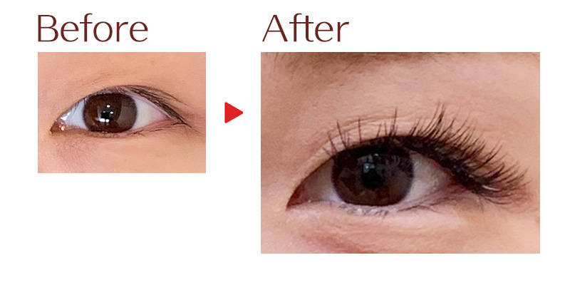 目元のビフォーアフター6